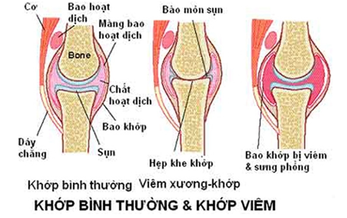 thiết bị tập thể dục ngoài trời